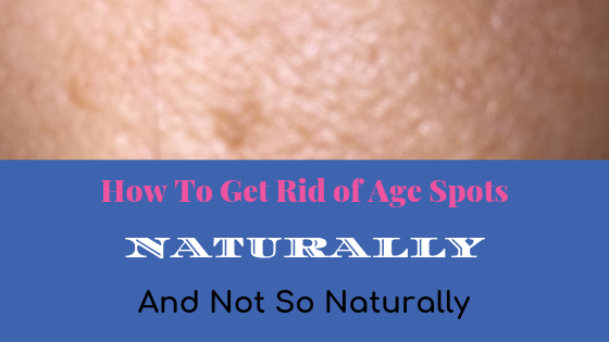 How To Get Rid of Age Spots Naturally (and not so naturally)