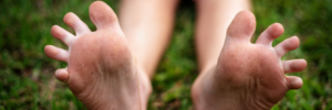 Is it unsanitary for  kids go barefoot? 
